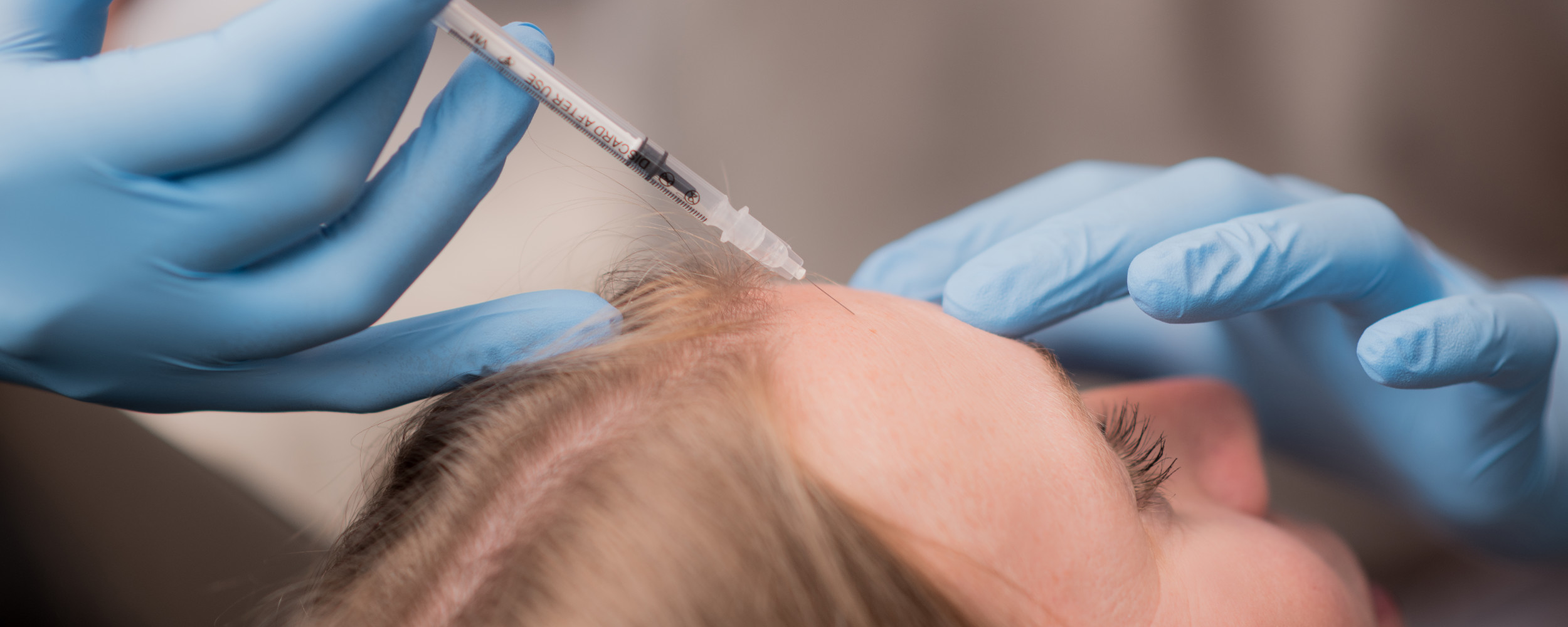 Nahaufnahme Unterspritzung an der Stirn einer Patientin